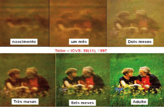 Projeto de Olho na Visão